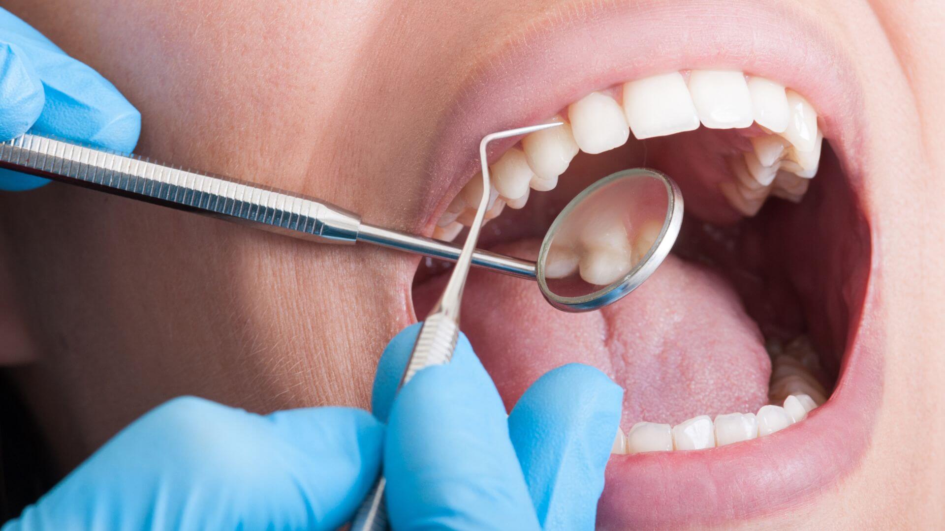 Igiene orale - Studio Dentistico Dott. Spatafora Alessandro a bergamo